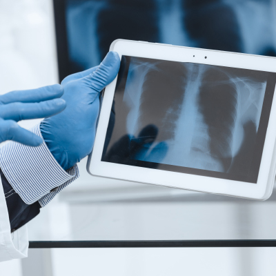 Procedimientos especializados